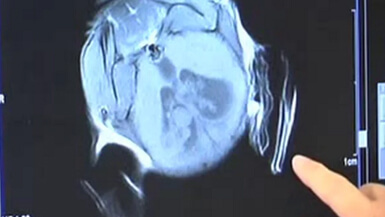 Contrast Agent Imaging